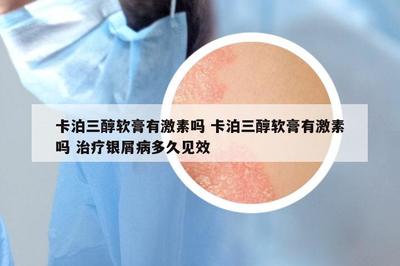 卡泊三醇软膏有激素吗 卡泊三醇软膏有激素吗 治疗银屑病多久见效