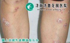 皮肤科诊疗项目