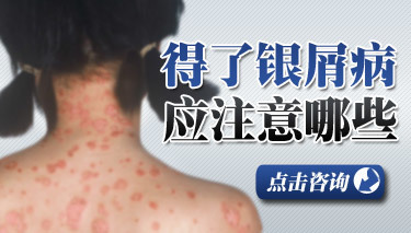 银屑病患者日常注意事项